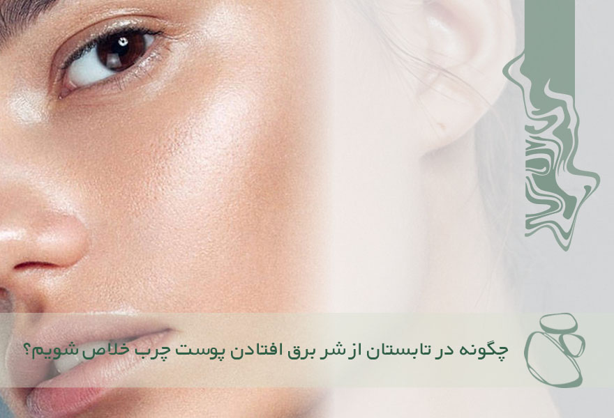 چگونه در تابستان از شر برق افتادن پوست چرب خلاص شویم؟ 